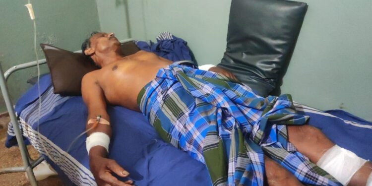 ಪುತ್ತೂರು # ಕಾಡು ಹಂದಿ ದಾಳಿ # ಗಂಭೀರ ಗಾಯ.