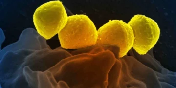 ವಿಶ್ವವನ್ನೇ ನಡುಗಿಸಿದ ಕೋವಿಡ್‌ ನಂತರ ಮತ್ತೊಂದು ಡೇಂಜರಸ್ ಕಾಯಿಲೆ ಆತಂಕ ಮೂಡಿಸಿದ ಮಾಂಸ ಭಕ್ಷಕ ಬ್ಯಾಕ್ಟೀರಿಯಾ; ಸೋಂಕು ತಗುಲಿದ 48 ಗಂಟೆಯಲ್ಲೇ ಸಾವು!