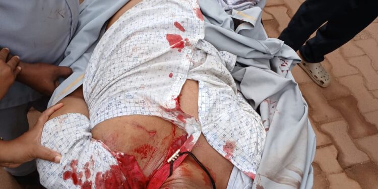 ಪುತ್ತೂರು: ಬೈಕ್, ಪಿಕಪ್ ಡಿಕ್ಕಿ – ಅಮ್ಚಿನಡ್ಕದ ಕ್ಷೌರಿಕ ಮೃತ್ಯು