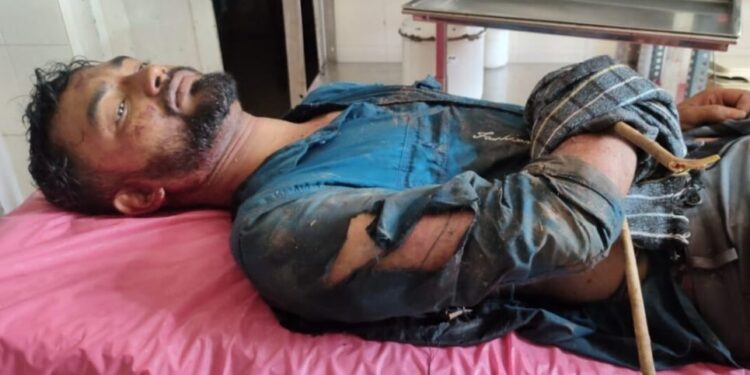 ಪುತ್ತೂರು : ಕಾಡು ಹಂದಿ ದಾಳಿ –ಪುತ್ತೂರು ತಾಲ್ಲೂಕು ಕುಂಬ್ರ ಪೆಟ್ರೋಲ್ ಪಂಪ್ ನೌಕರ ತೀವ್ರ ಗಾಯ.