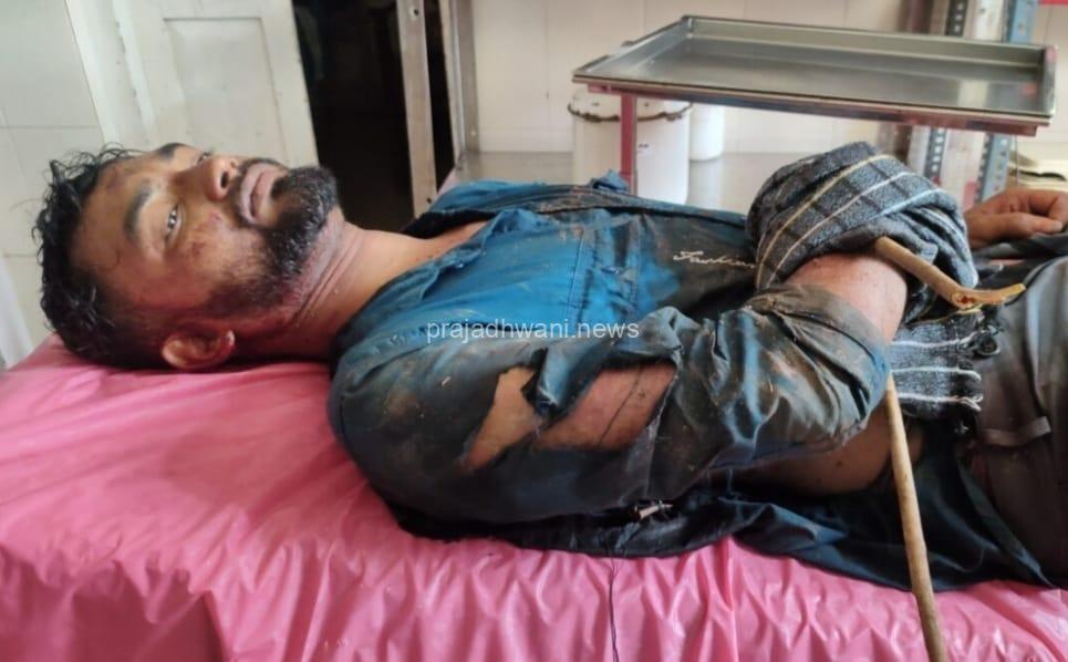 ಪುತ್ತೂರು : ಕಾಡು ಹಂದಿ ದಾಳಿ –ಪುತ್ತೂರು ತಾಲ್ಲೂಕು ಕುಂಬ್ರ ಪೆಟ್ರೋಲ್ ಪಂಪ್ ನೌಕರ ತೀವ್ರ ಗಾಯ.