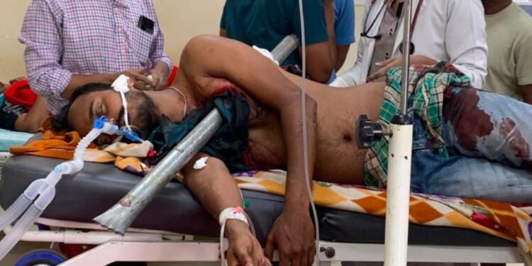 ಭೀಕರ ಅಪಘಾತದಲ್ಲಿ ಲಾರಿ ಕ್ಲೀನರ್ ಎದೆಯೊಳಗೆ ಹೊಕ್ಕಿದ ಕಬ್ಬಿಣದ ಪೈಪ್ ಹೊರ ತೆಗೆದ KMCRI ವೈದ್ಯರು : ವೈದ್ಯರ ಕೆಲಸಕ್ಕೆ ಭಾರಿ ಪ್ರಶಂಸೆ