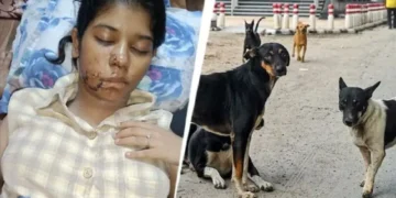 ಬೀದಿ ನಾಯಿ ಕಚ್ಚಿ ಕಾಲೇಜು ವಿದ್ಯಾರ್ಥಿನಿಯ ಮುಖಕ್ಕೆ 17 ಹೊಲಿಗೆ: ಸುಪ್ರೀಂ ಕೋರ್ಟ್ ಇತ್ತೀಚೆಗೆ  ಬೀದಿ ನಾಯಿಗಳ ತೀರ್ಪಿನ ಕುರಿತು ದೇಶಾದ್ಯಂತ ತೀವ್ರ ಪ್ರತಿಕ್ರಿಯೆಗಳು ವ್ಯಕ್ತವಾಗಿರುವ ನಡುವೆಯೇ ಈ ದಾಳಿ ನಡೆದಿದೆ.